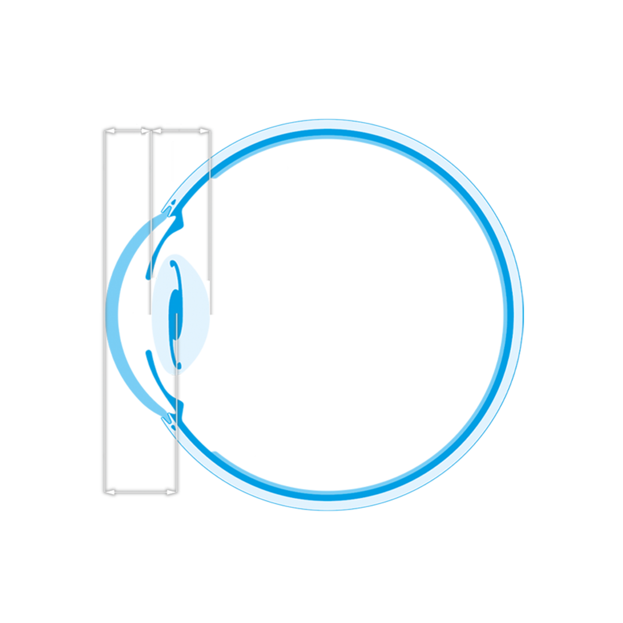 EyeSuite IOL - Olsen: the C-constant a new concept