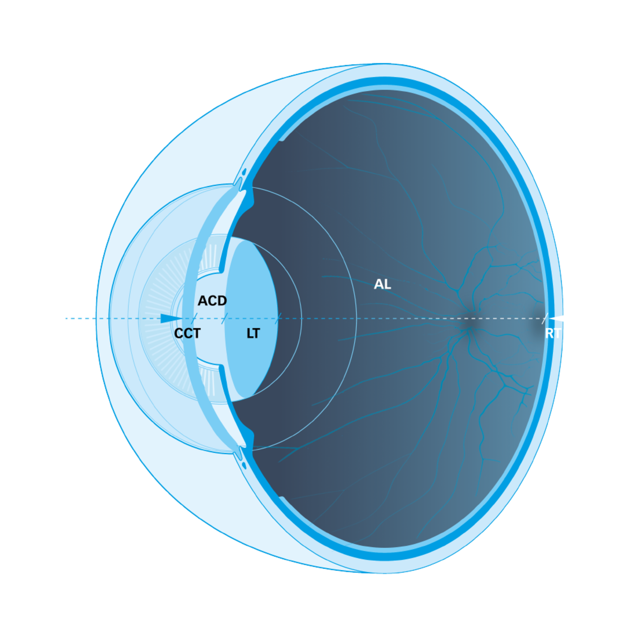 Lenstar 900 - Optical biometry