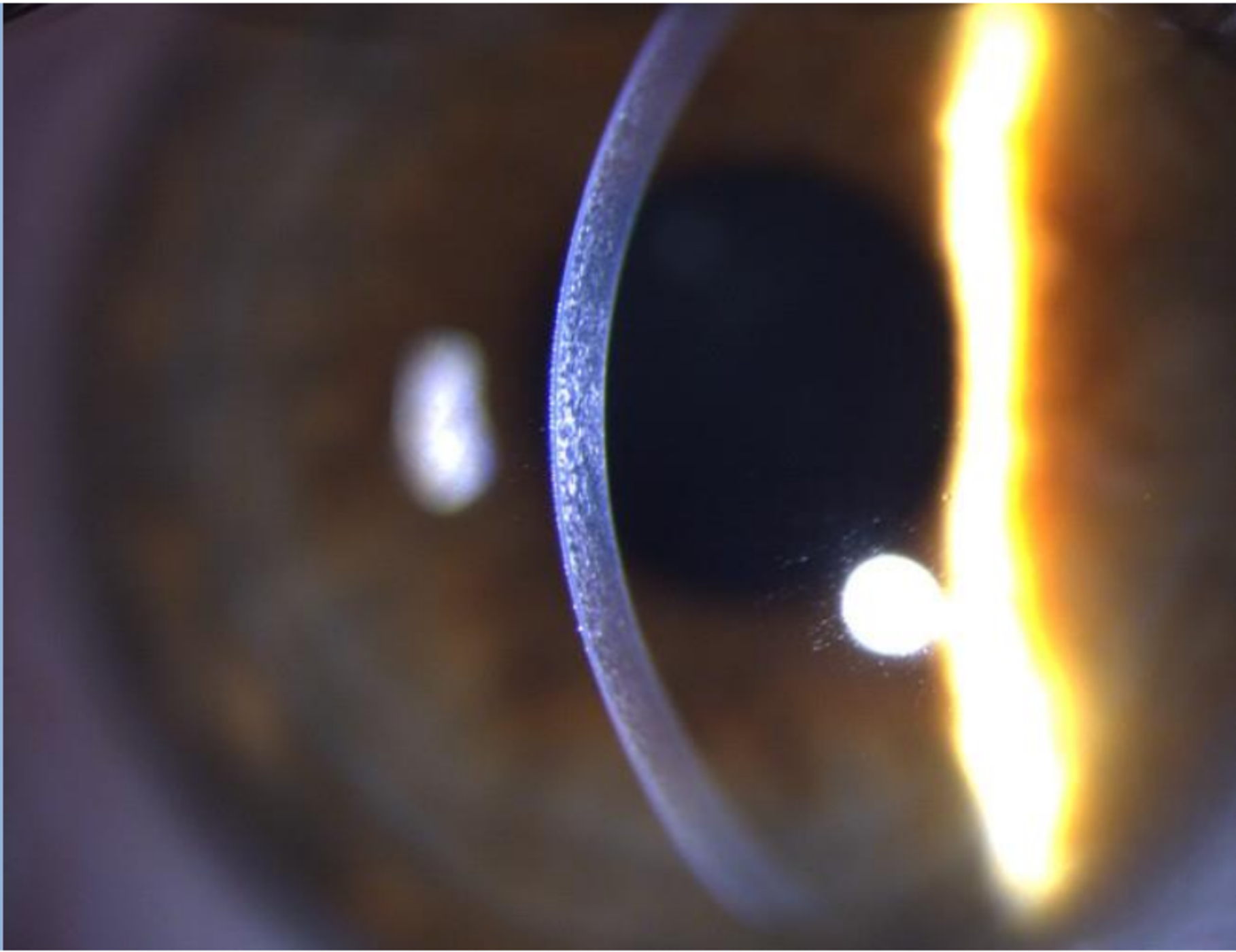 Haag-Streit Slit lamps